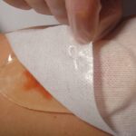 Aqua-Gel – tai tvarstis sunkiai gyjancioms zaizdoms. militra