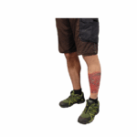 INJURY SIMULATION2025 03 19 212401