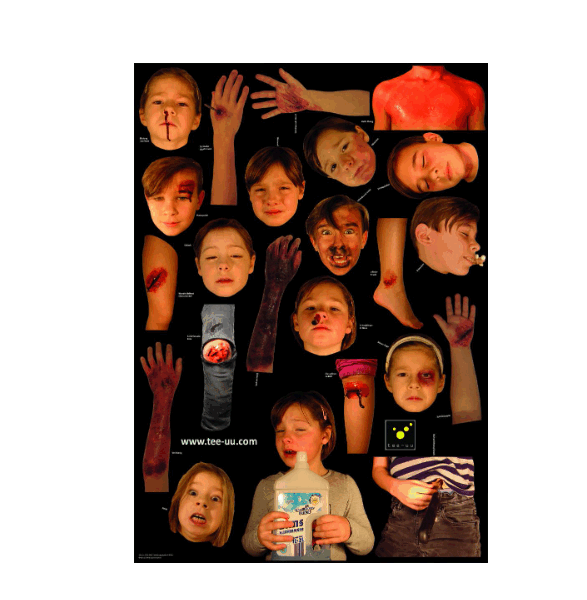 INJURY SIMULATION PATTERNS JUNIOR