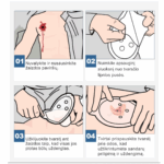 Instrukcija.kaip naudoti okliuzini tvarsti